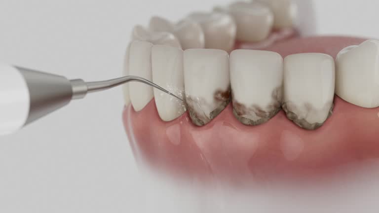 Reliable Dental Implants contractor in Cologne, NJ by Smile Center Dentistry